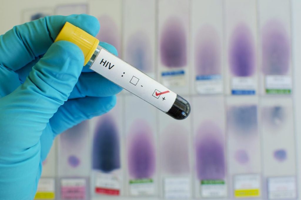 Medical Marijuana For HIV/AIDS