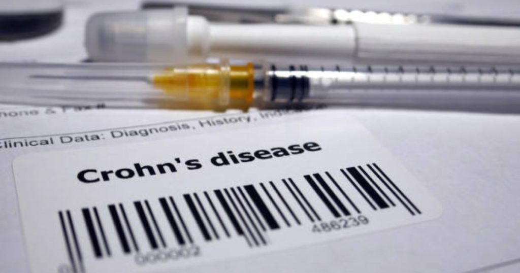 Medical Marijuana for Crohn's Disease